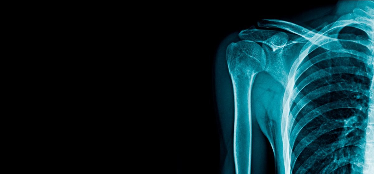 Don’t Sleep on Shoulder Procedures!